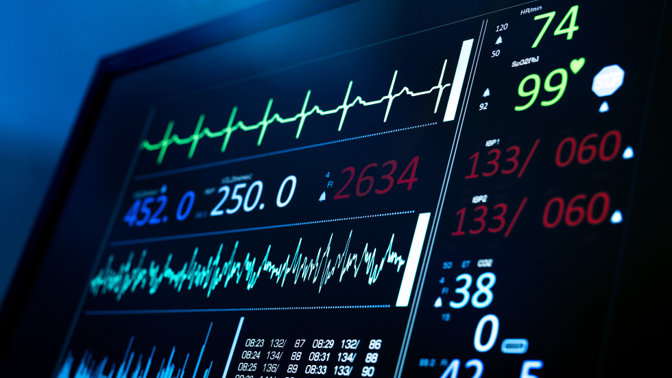 time-based test sessions , Continuous Quality Monitoring